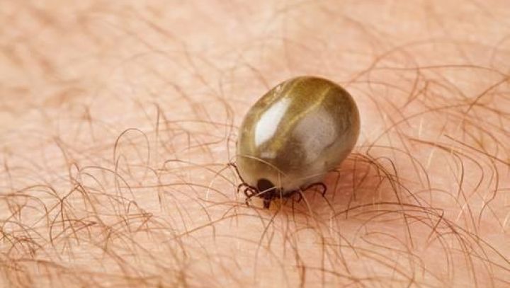 Zoonosen